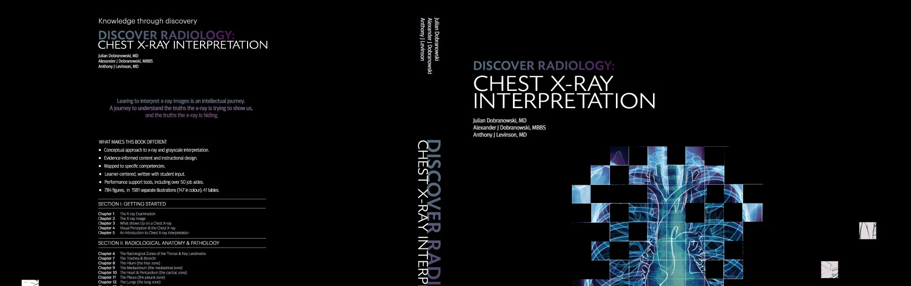 Discover Radiology: Chest X-ray Interpretation