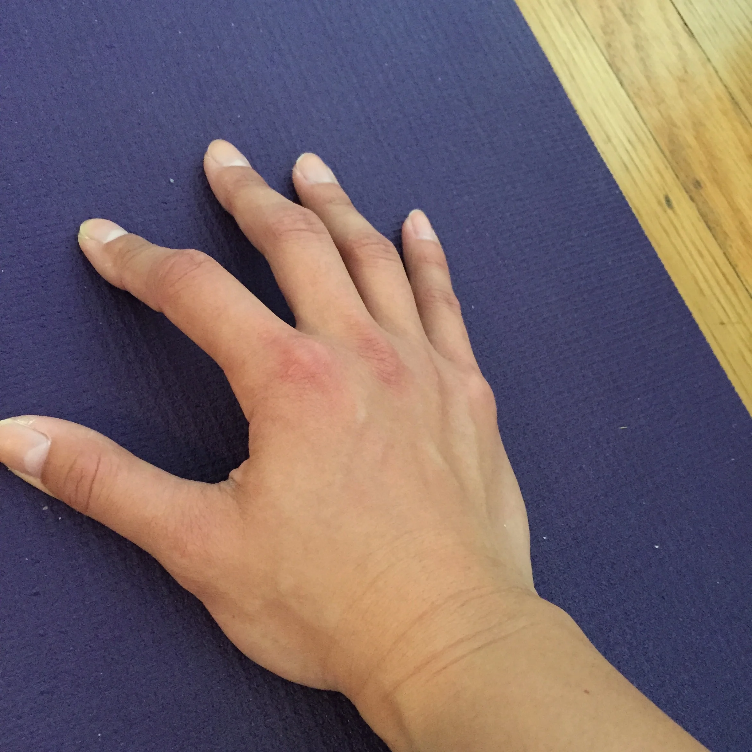 Wrong option #2: The inner palms and fingers are lifted, which create instability in the hands and upper body while in downward facing dog. This also creates a lot of pressure in the wrists. 