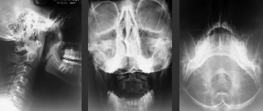 scans.jpg