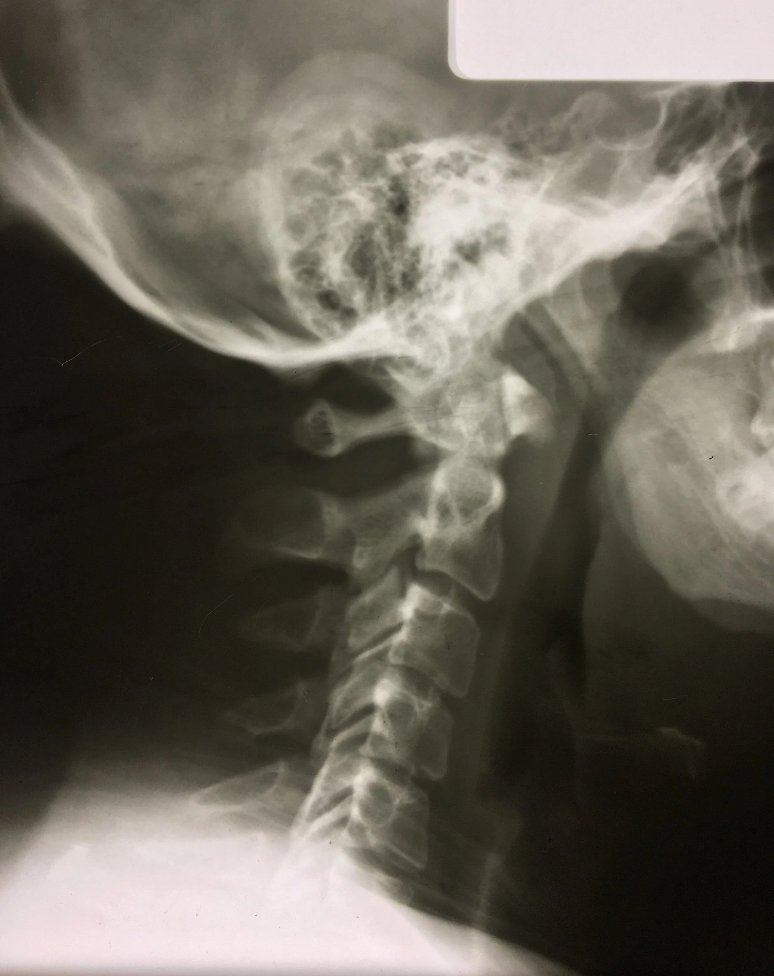 9 Common Questions About Chiropractic X-rays
