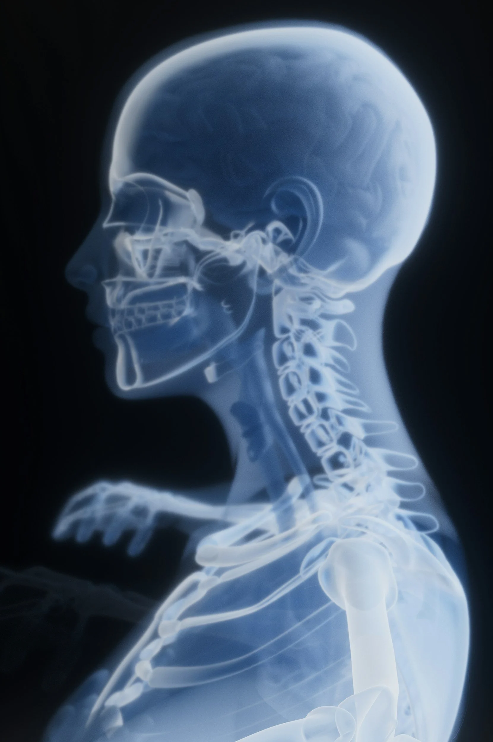 Why Adjust the Same Bone?