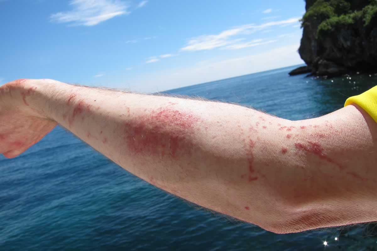 Marine Bites