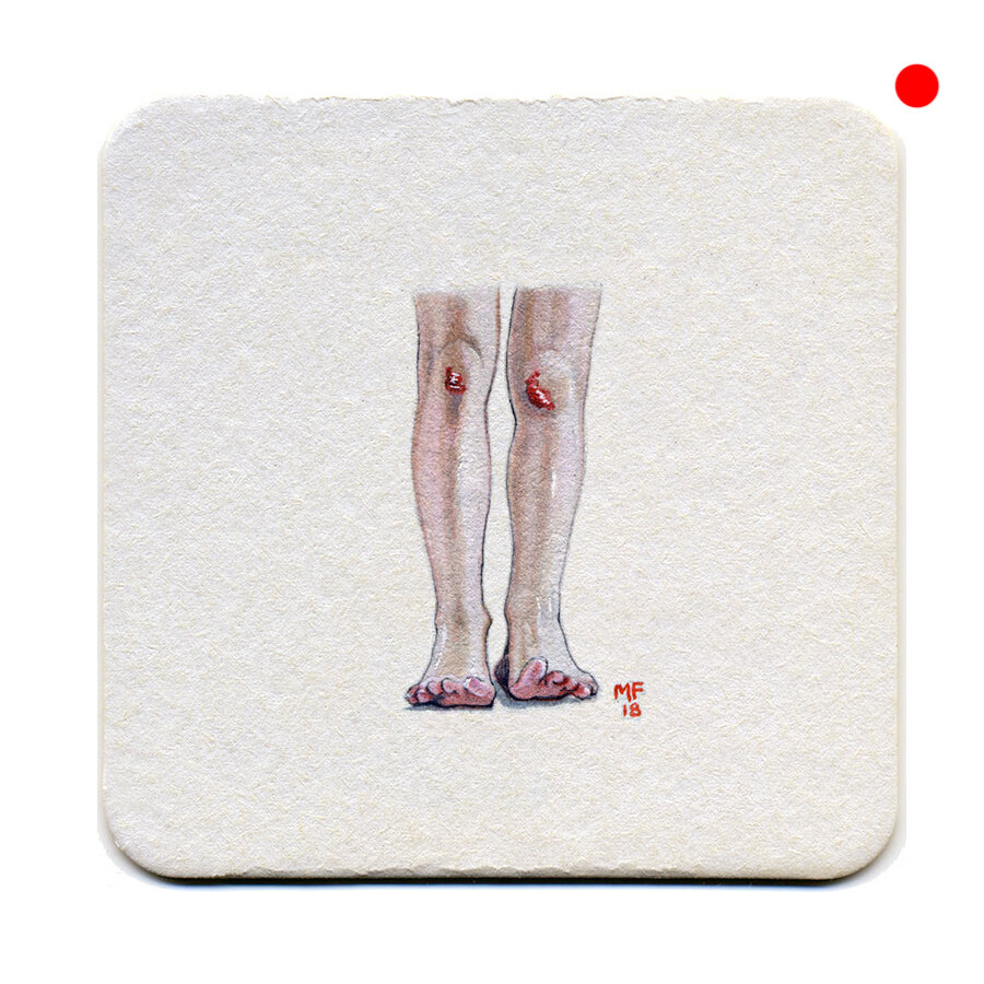 365_29(knee-skinned)cc.jpg