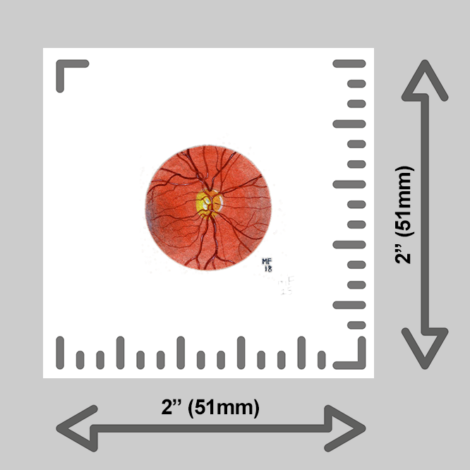 tiny-prints-25-fundus-retina(ruler).png