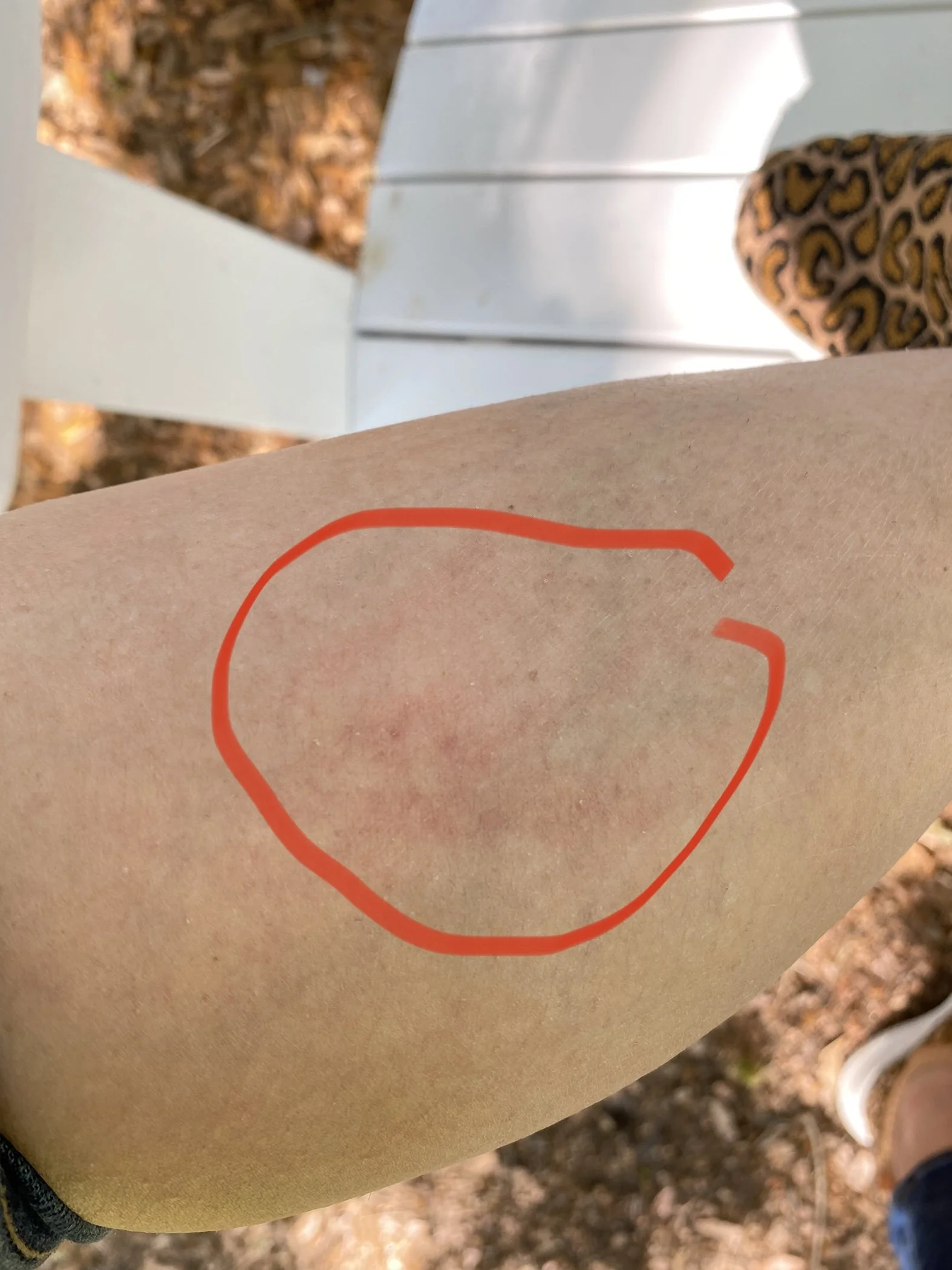 Lizard Bite in Ocala, FL