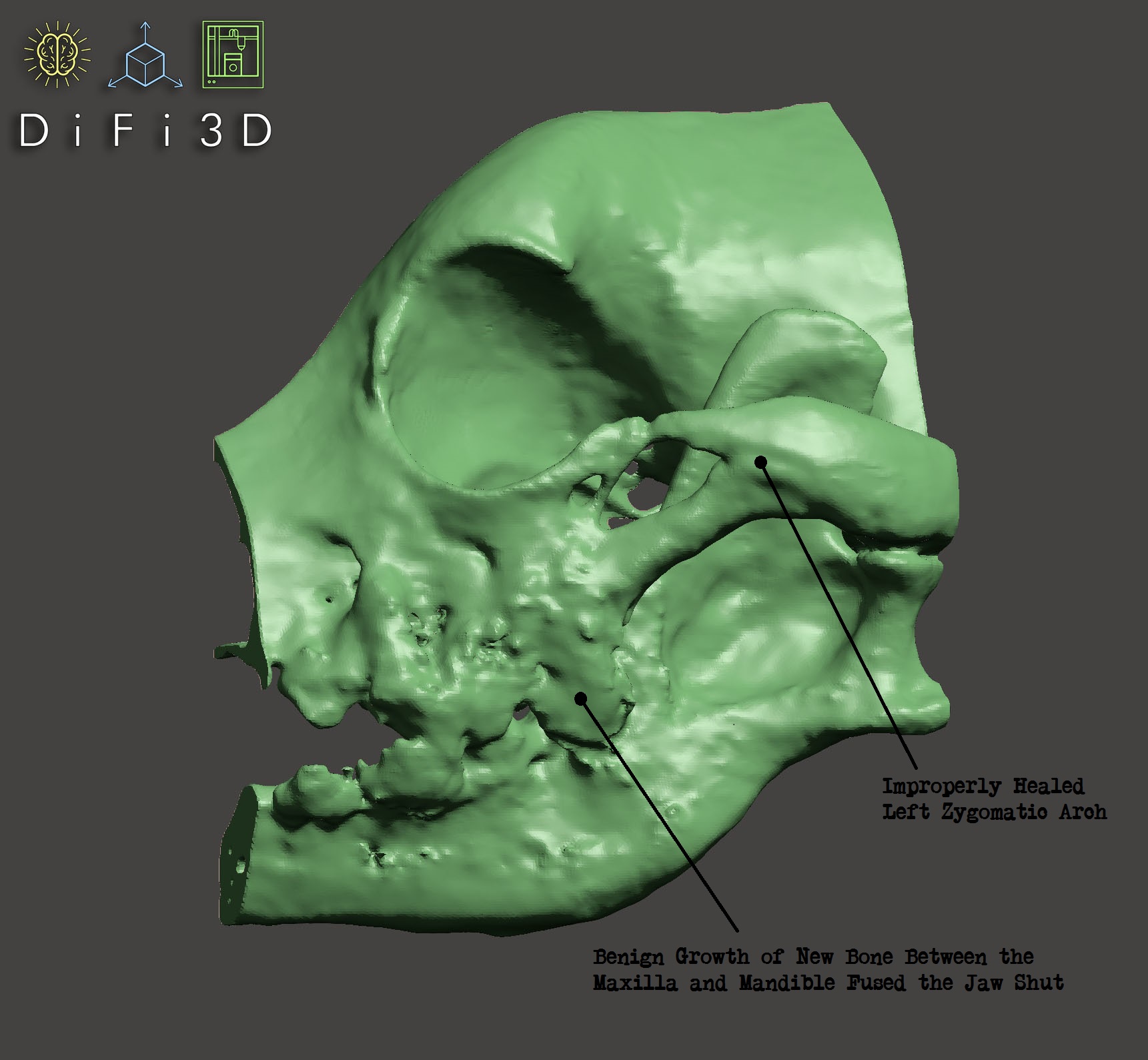 3D CAD Model of the Region of Interest