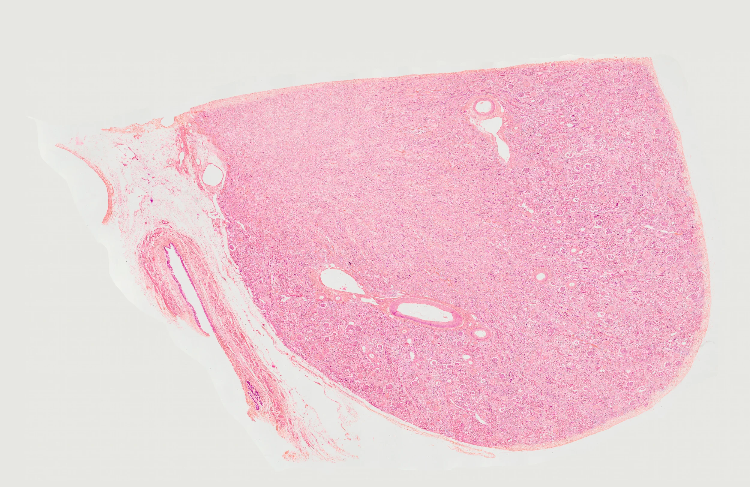  Full specimen, diabetic kidney  260 image stitched panorama  2015&nbsp; 