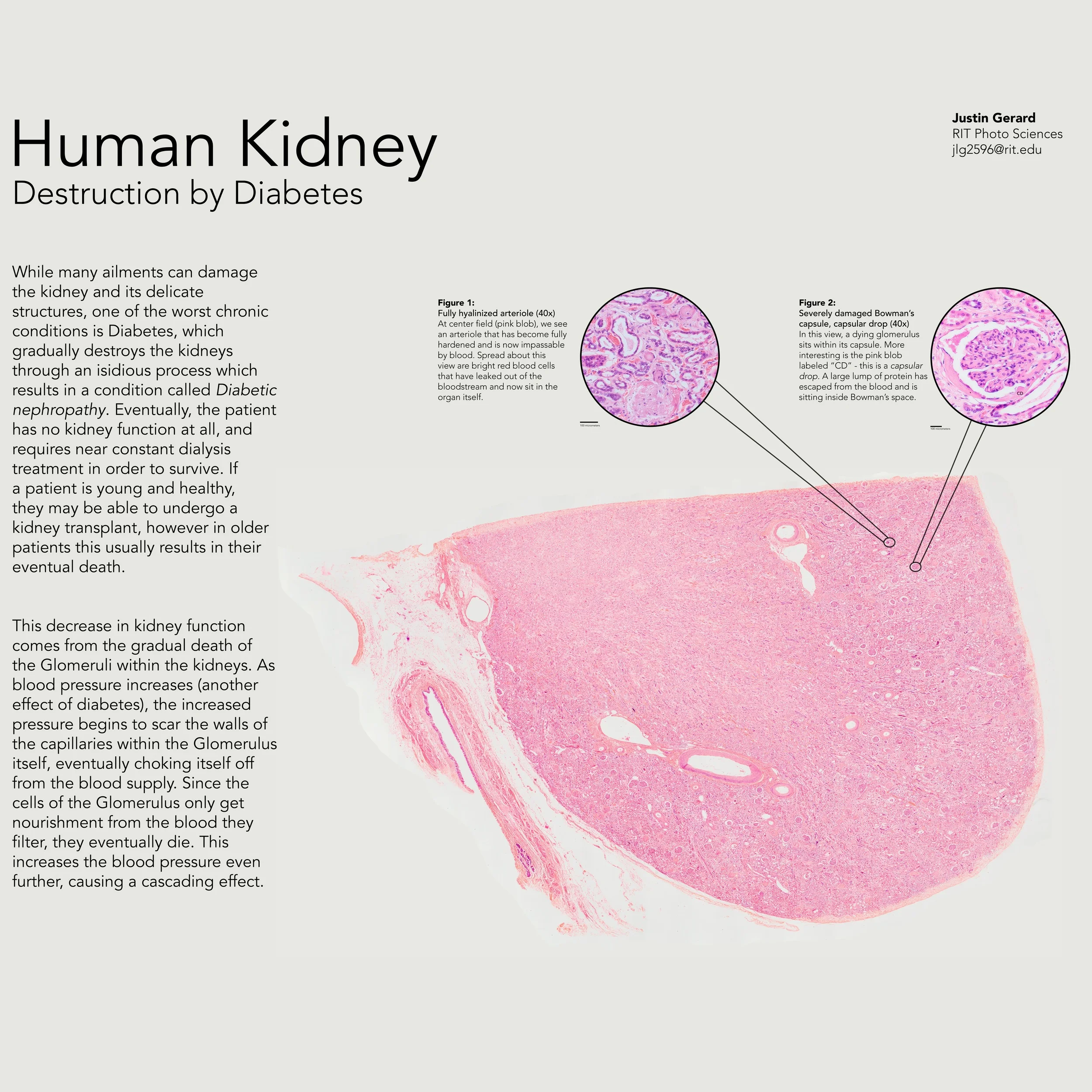  Poster layout, created for Scientific Photography II  2015 