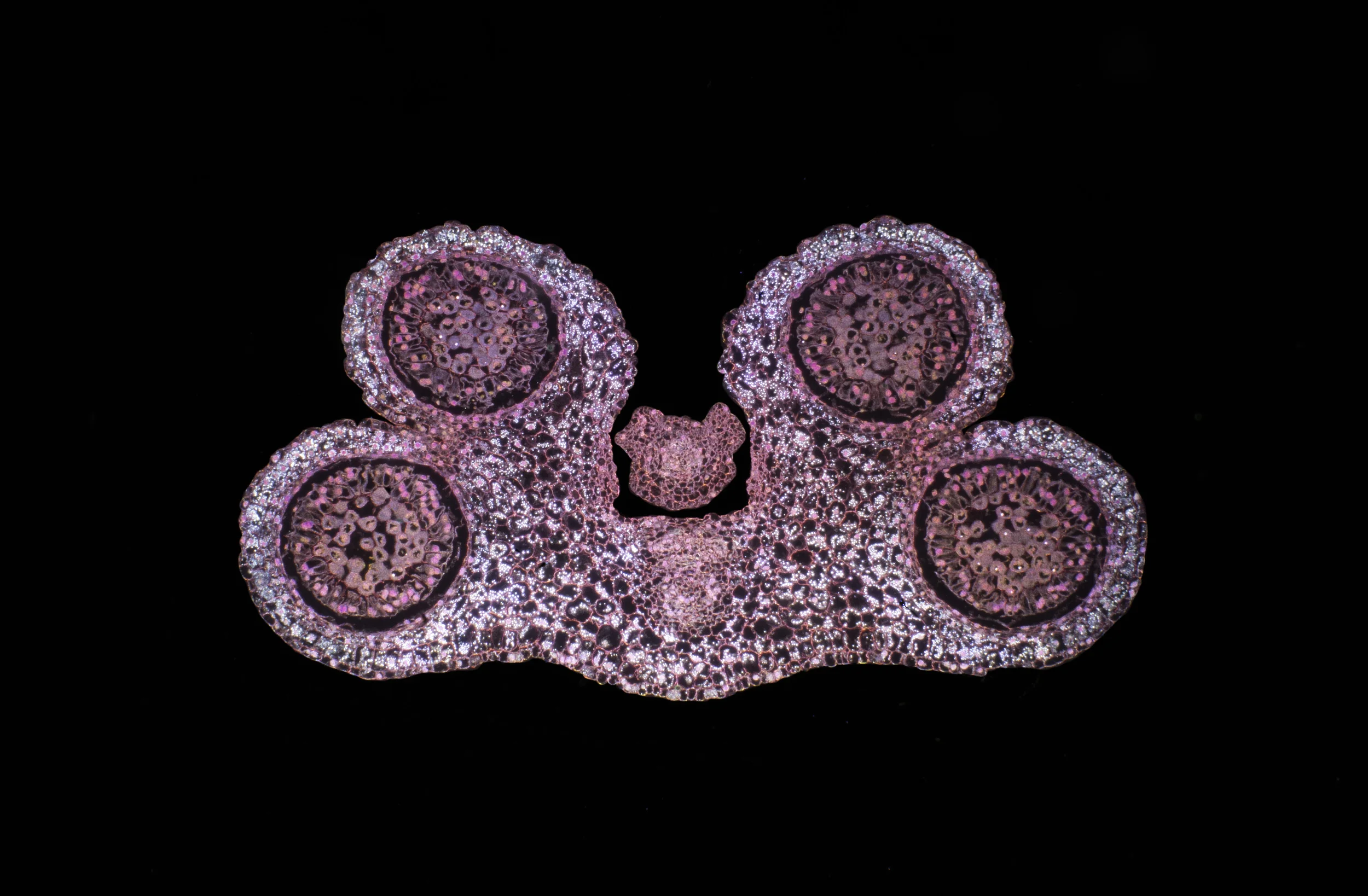 Lily Anther, 5x, darkfield