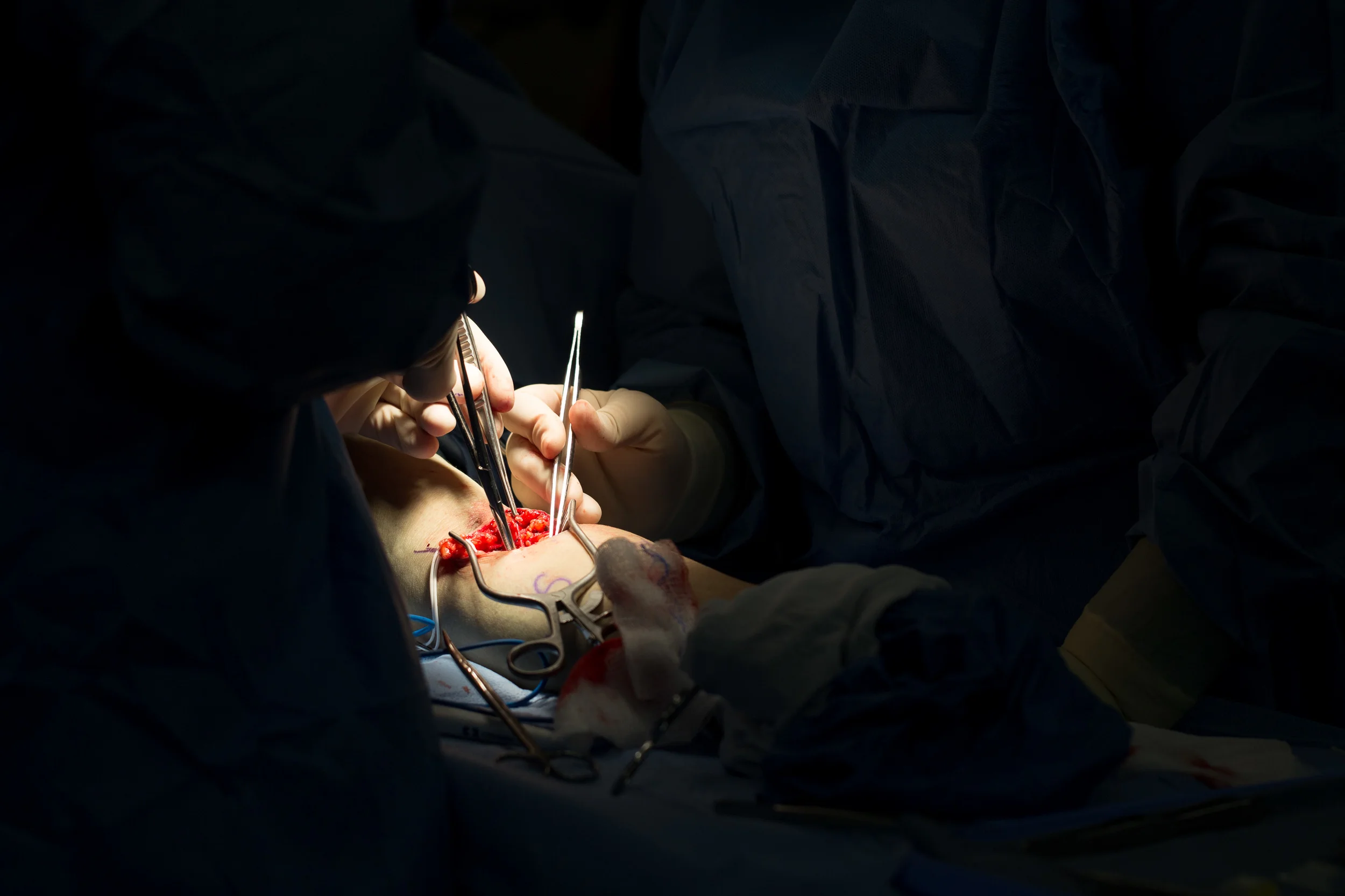  A surgeon performs a vein transposition, a procedure to provide a port in the arm for dialysis. 