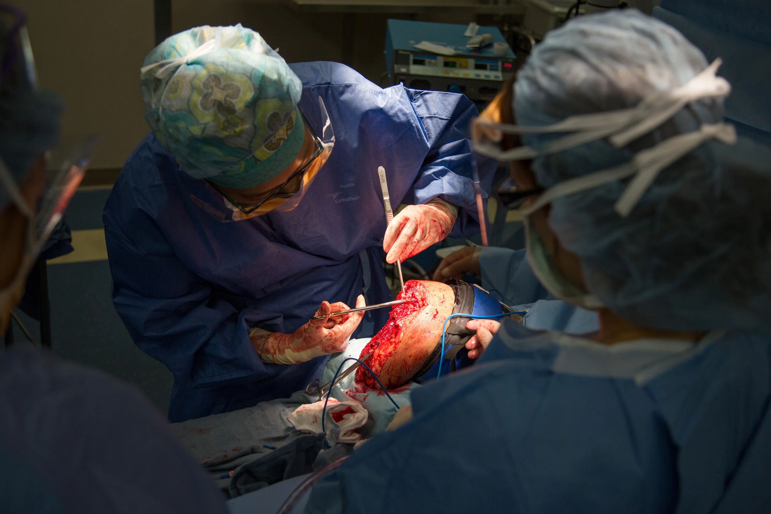  A surgeon closes blood vessels on leg after amputation.&nbsp; 