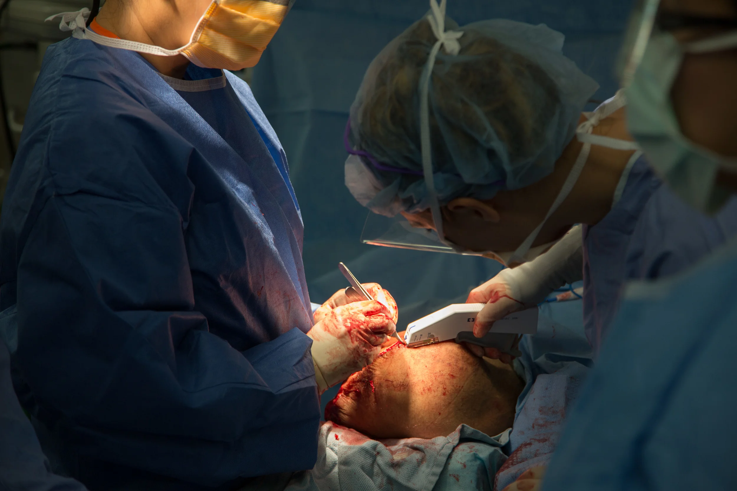  The surgical team staples the patient's leg. 