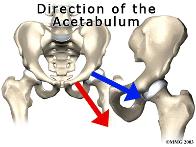 Blue: A more lateral facing socket makes turnout easier in contrast to a more forward facing socket (in Red).