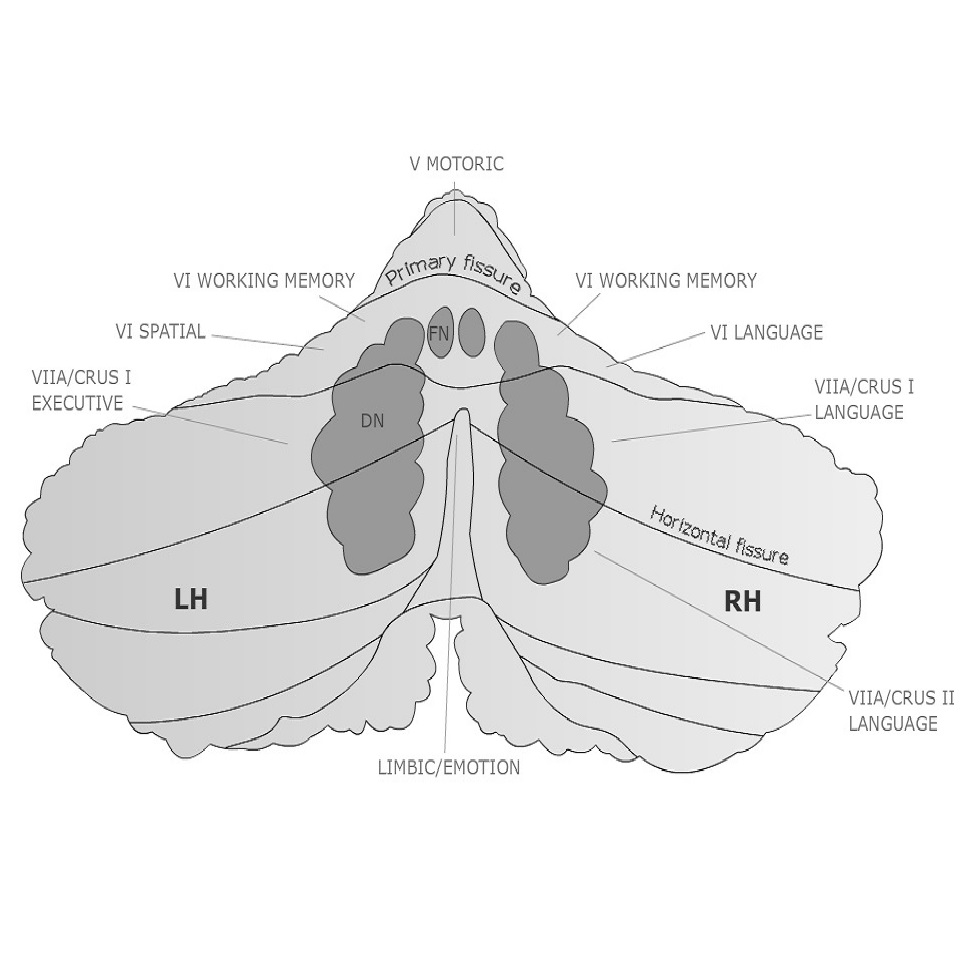 Topography of the cerebellum (simplified). Designed by Dr. Thora Gudrunardottir 2010. © Copyright by Child's Nervous System (Springer)