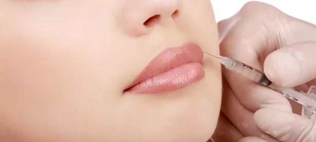 dermal-fillers-0800190514.jpg