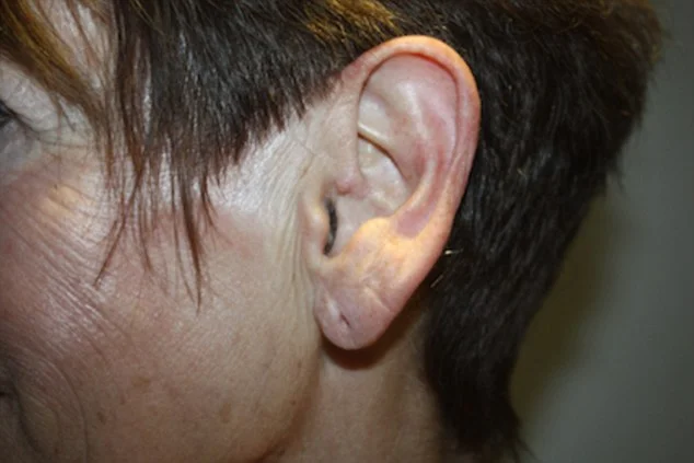 after-eartox-filler-1428130814.jpg
