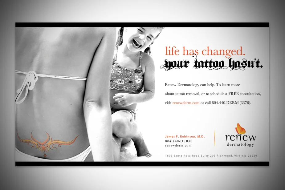 Renew Tattoo Removal Print Ad