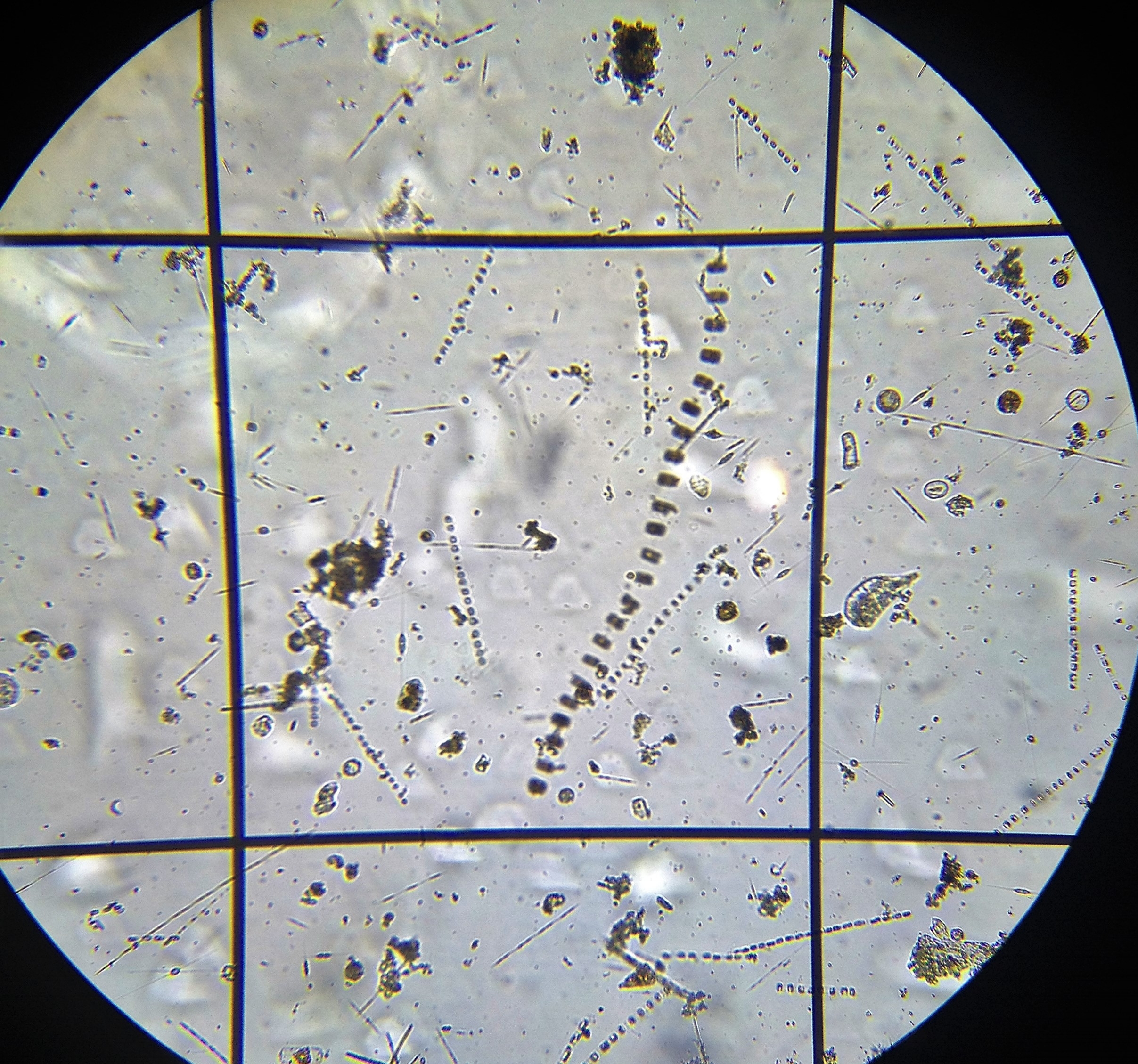 An array of different species, including thin chains of Pseudo-nitzschia