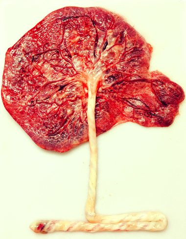 placenta tree of life.png