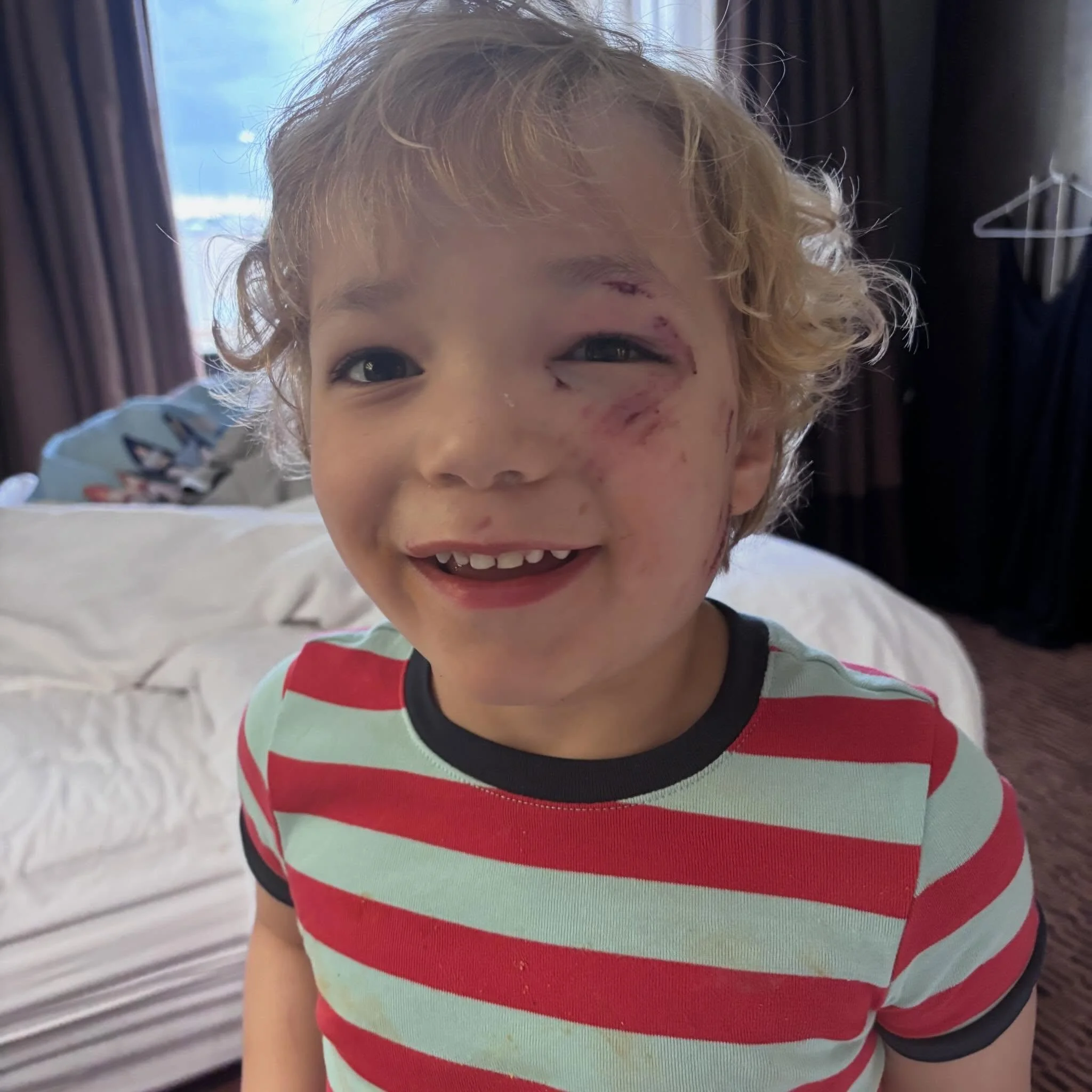 This week we headed to Dallas for a much needed vacation. We stopped at a friend&rsquo;s house for dinner on our first night and their dog ended up attacking Malcolm. He has 15 stitches on his face.

We spent a terrifying night&mdash;12 hours in the 