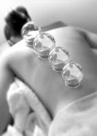 Static cupping of the myofascia