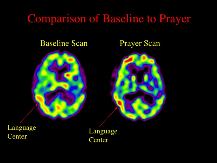  When we looked at the brains of Franciscan nuns in prayer, we found&nbsp;increased activity in the frontal lobes (same as Buddhists), but also increased activity in the inferior parietal lobe (the language area). This latter finding makes sense in r