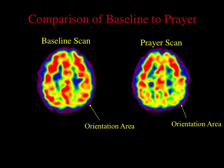  The nuns, like the Buddhists, also showed decreased activity in the orientation area (superior parietal lobes) of the brain. A more thorough description of the results from this study can be found in my book&nbsp; Why We Believe What We Believe ,&nb