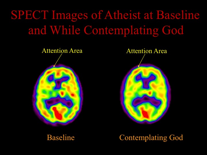  We also looked at the brain of a long-term meditator who was also an atheist. We scanned the person at rest and while meditating on the concept of God. The results showed that there was no significant increase in the frontal lobes as with the other 