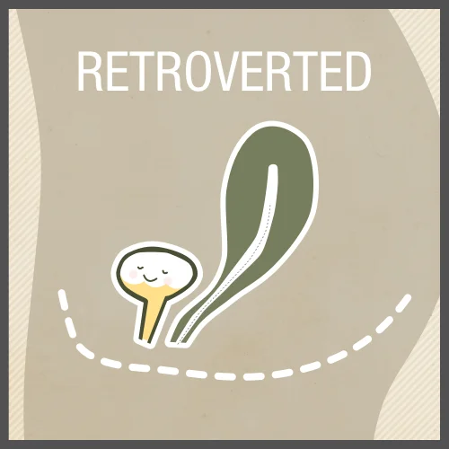 For some women, the uterus is consistently tipped back towards their tailbone, which means you won't need help from your bladder to line everything up.