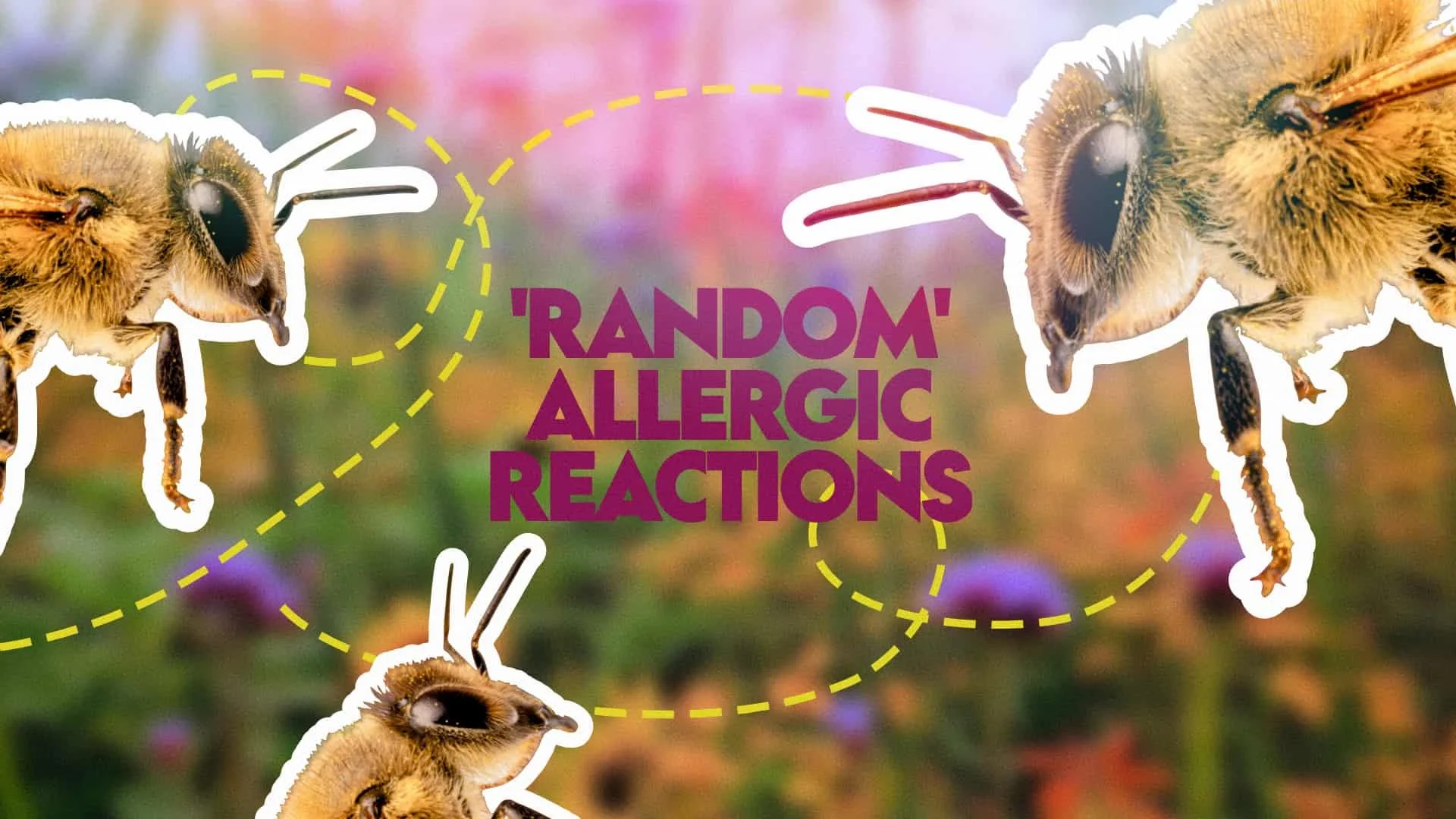 THE OVERLOOKED CAUSE OF ‘RANDOM’ ALLERGIC REACTIONS