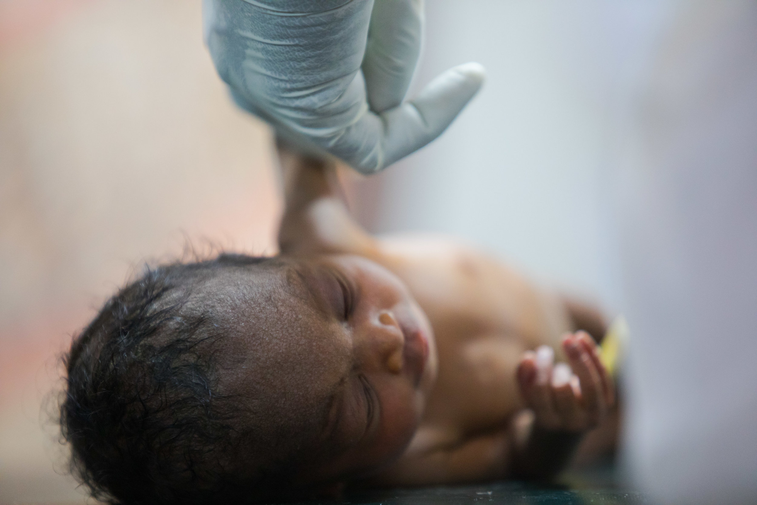 A baby receives treatment at an MSF run hospital in Aweil, South Sudan