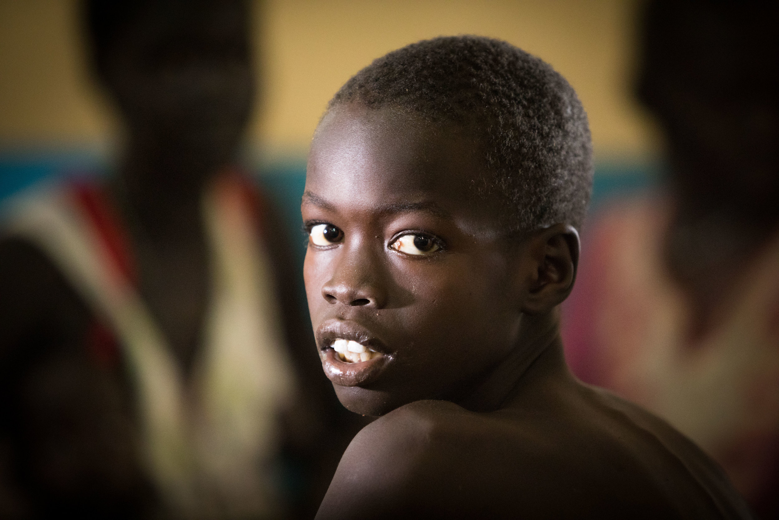 A young boy in the MSF run hospital in Aweil, South Sudan