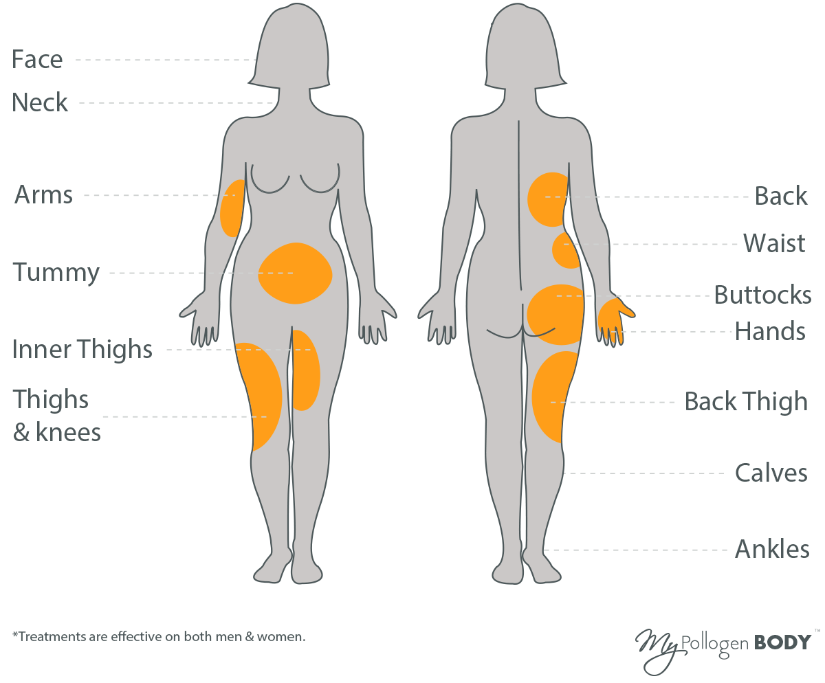 LipofirmPro-treatment-areas.png