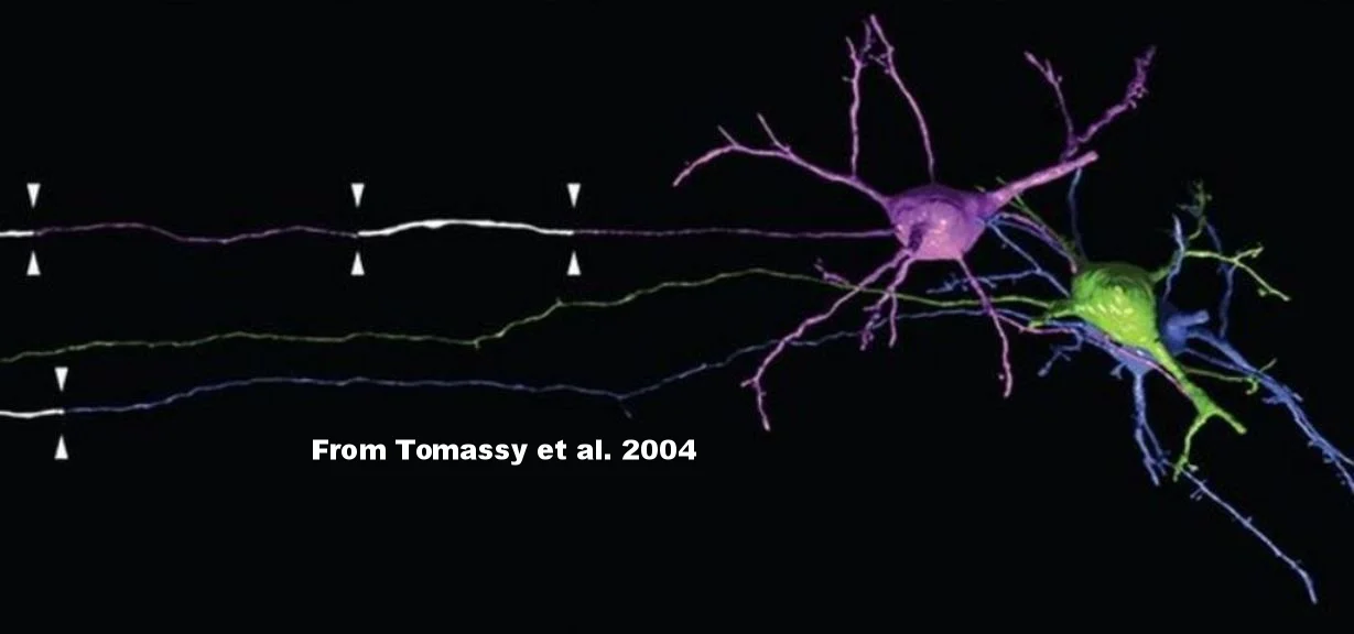 Imaging the insulation material (myelin) around individual nerve fibers 