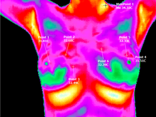  This is my Thermography scan from May 2016