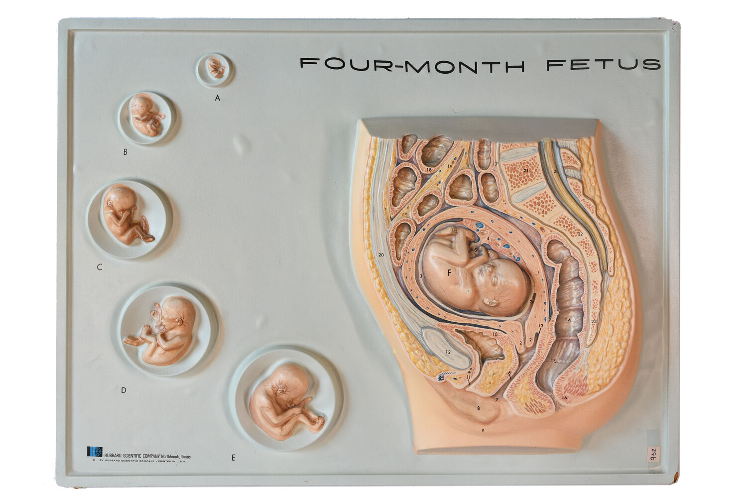 vacuform-fetus-model