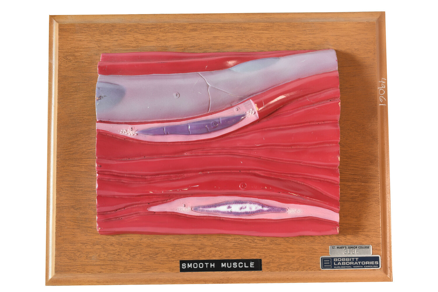 smooth-muscle-model-on-plaque