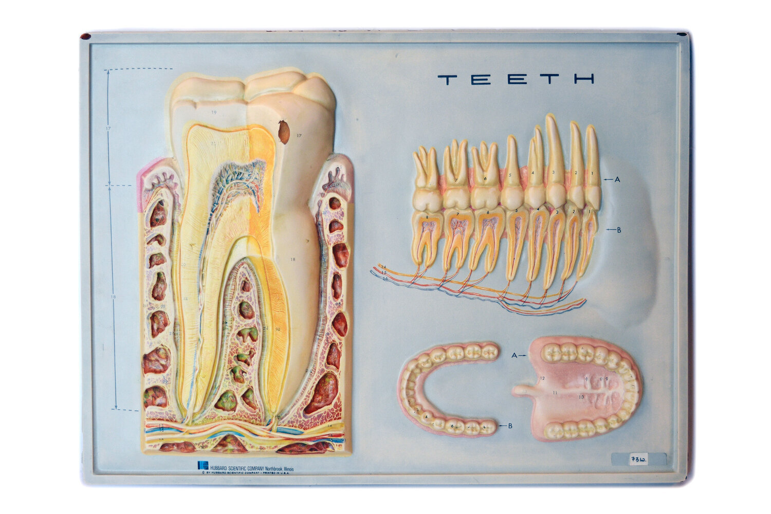 teeth-cross-section-3d-diagram
