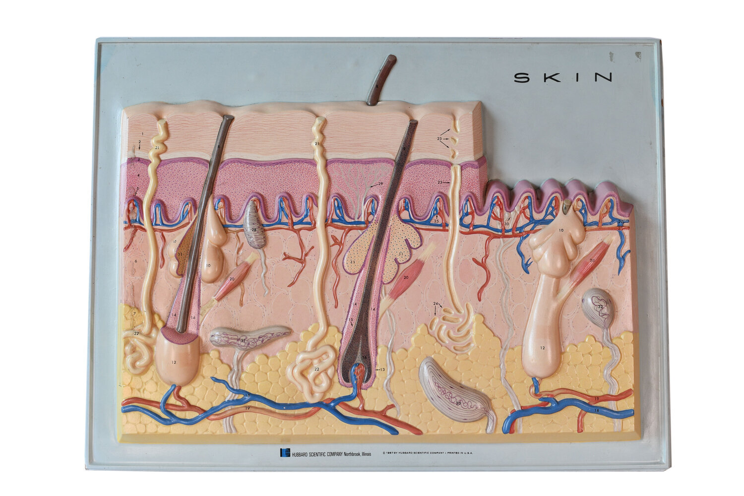 vacuform-skin-model