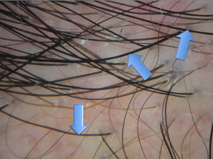 Slide1terminalhairs.jpg