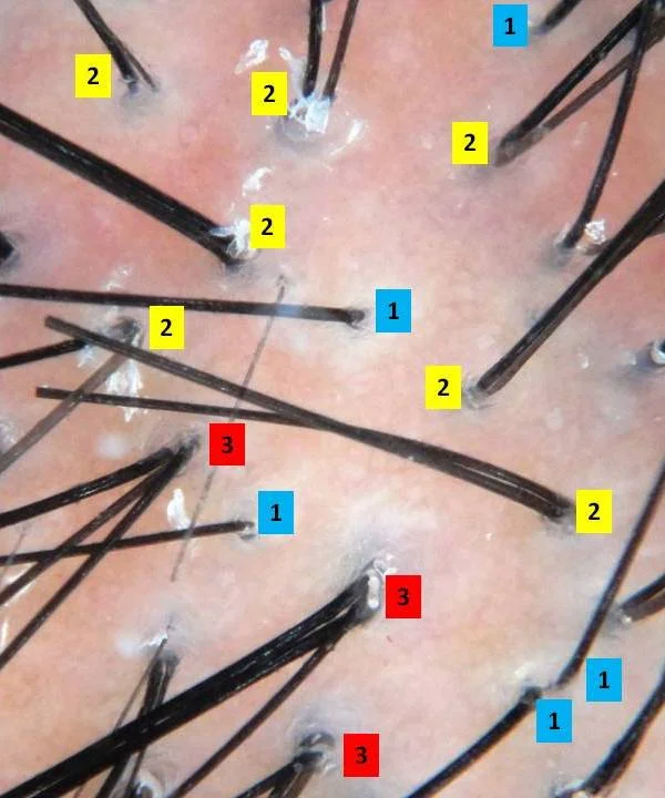 one two three hairs.jpg