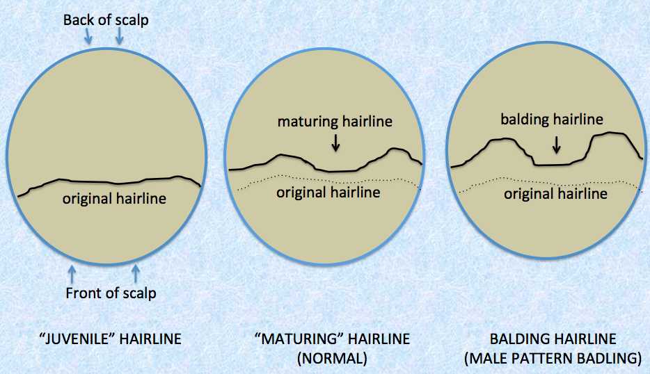Hairline Chart