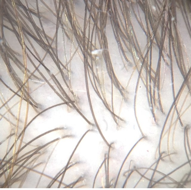 ZINC — Donovan Hair Clinic