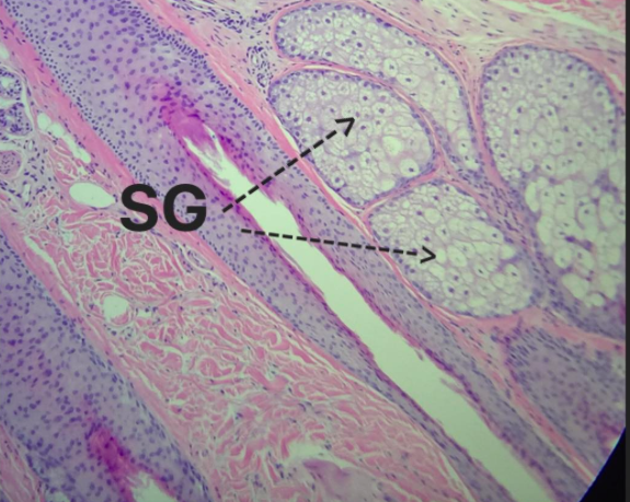 Sebaceous Glands Under Microscope