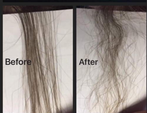 Can minoxidil change hair texture? — Donovan Hair Clinic