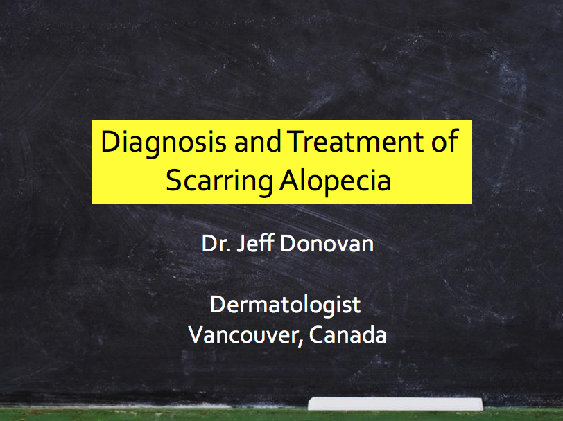 Diagnosis & Treatment of Scarring Alopecia