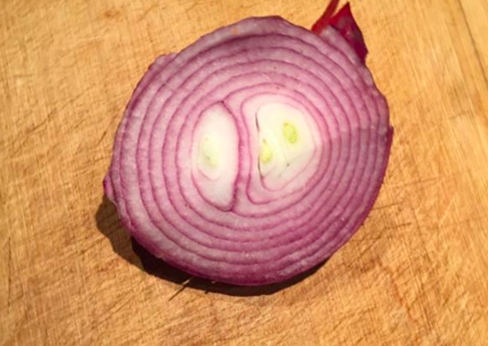 Onion extracts for alopecia Areata: Small study suggested benefit — Donovan  Hair Clinic
