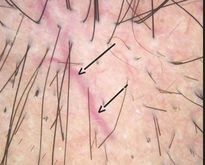 corticosteroids.png