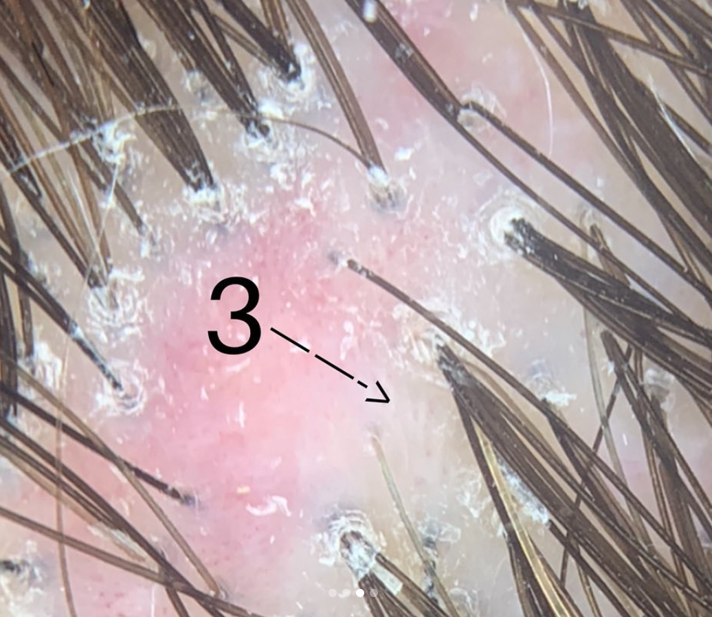 Dr. Donovan's Hair Loss Articles (20112020) — Donovan Hair Clinic