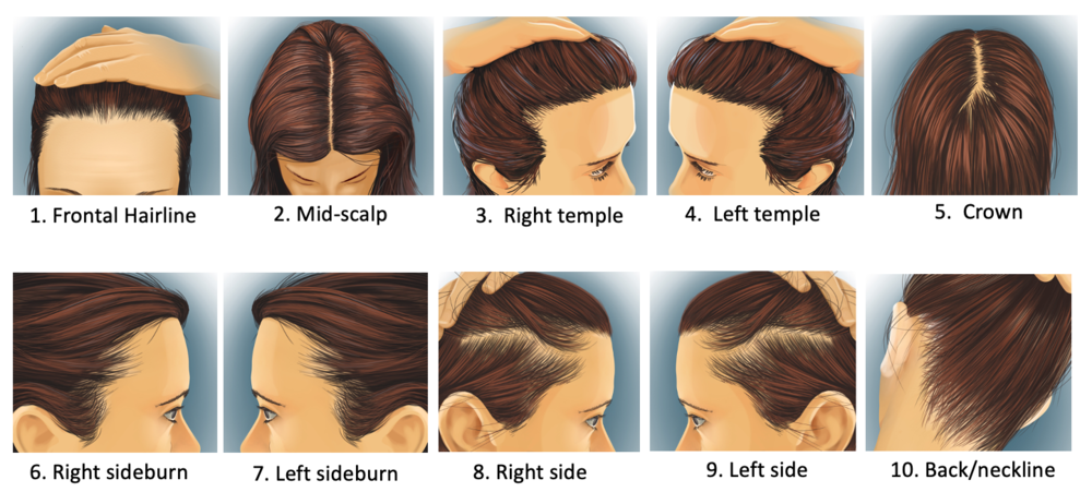 OUR 10 IMAGE PATIENT PHOTO GUIDE — Donovan Hair Clinic